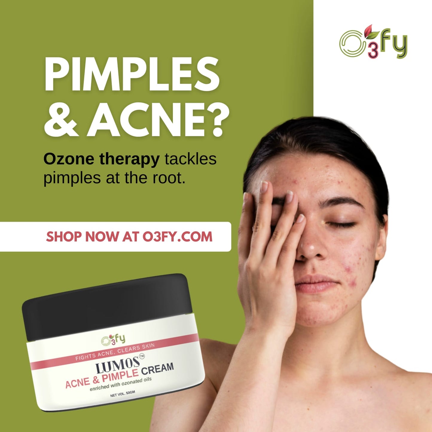 LUMOS Acne & Pimple Cream