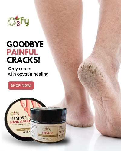 Cracked heels O3FY Lumos Hand & Feet Cream