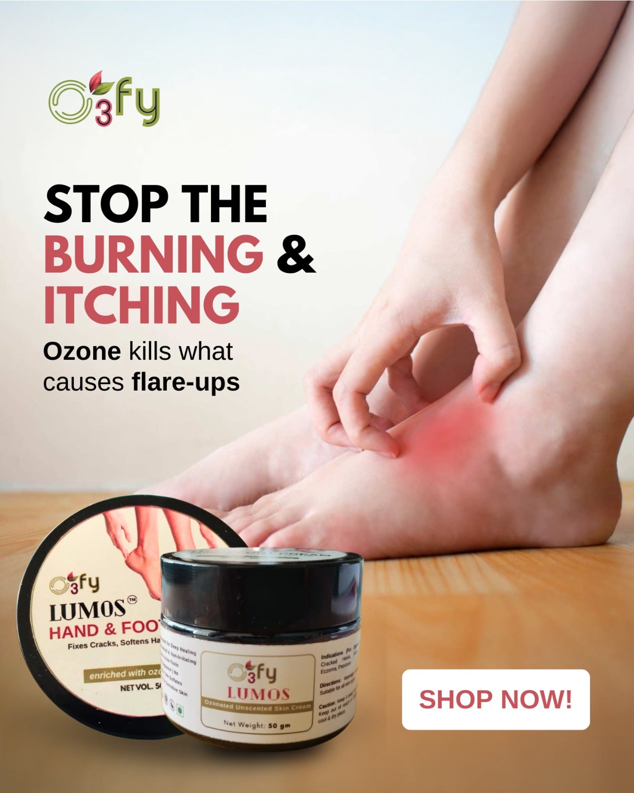 Cracked heels and dry hands_Burning & Itching_O3FY Lumos Hand & Feet Cream