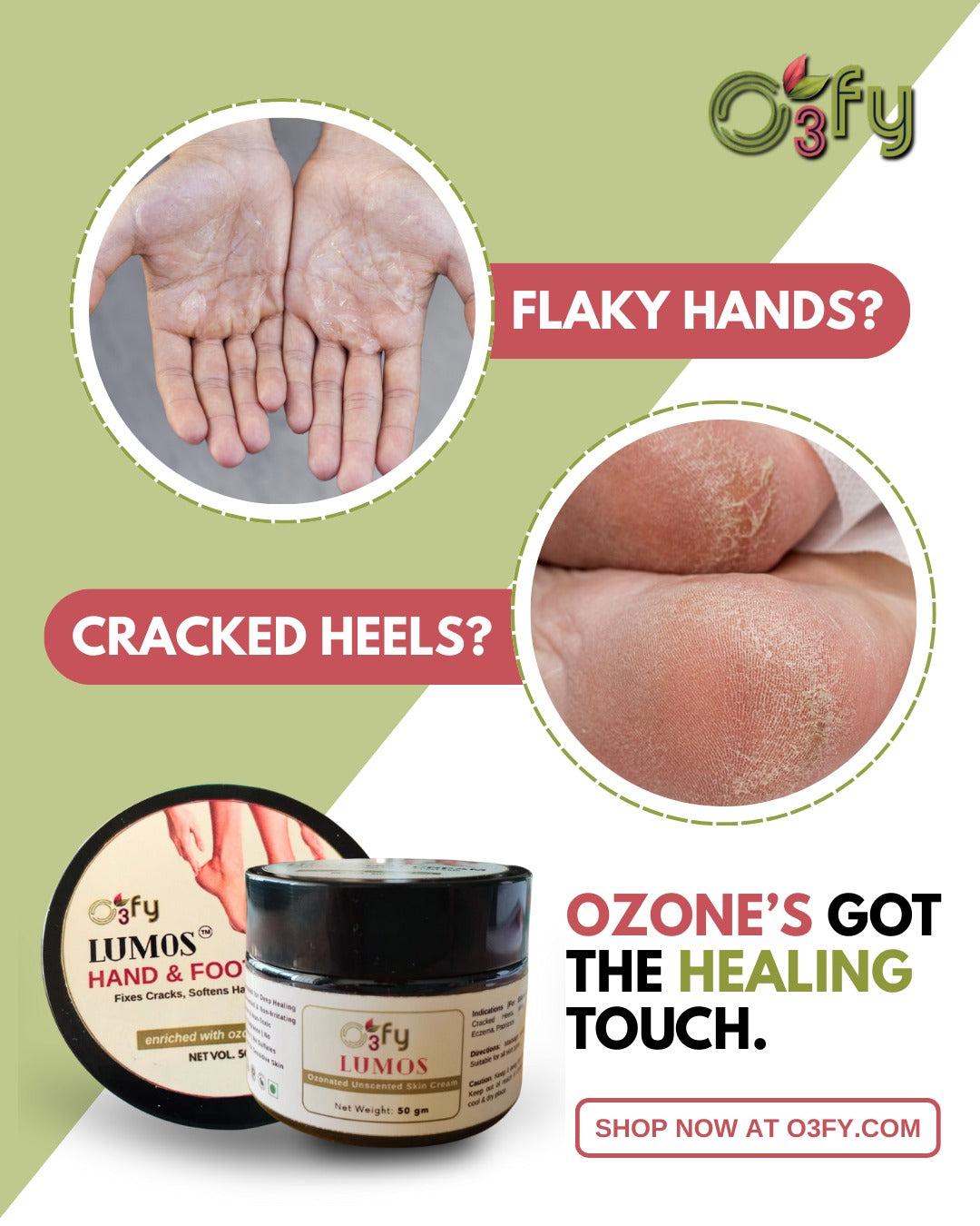 Flaky Hands_Cracked heels_O3FY Lumos Hand & Feet Cream