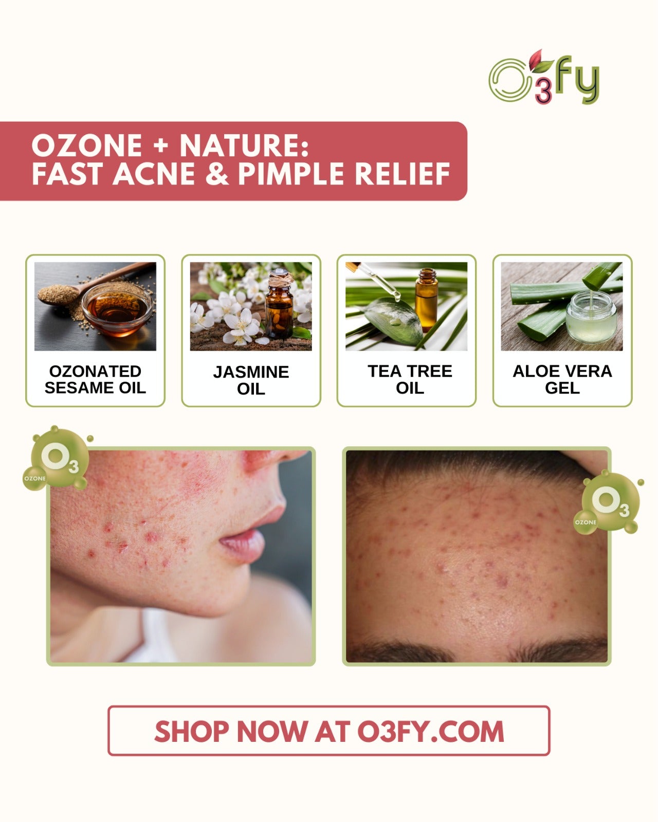 Lumos acne & Pimple Cream-Ingredients
