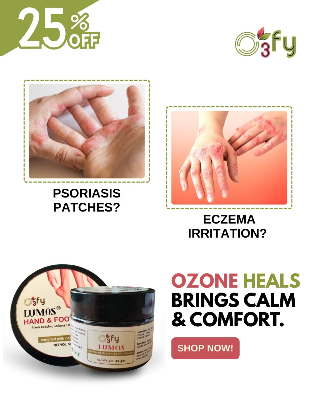 Psoriasis_Eczema_O3FY Lumos Hand & Feet Cream