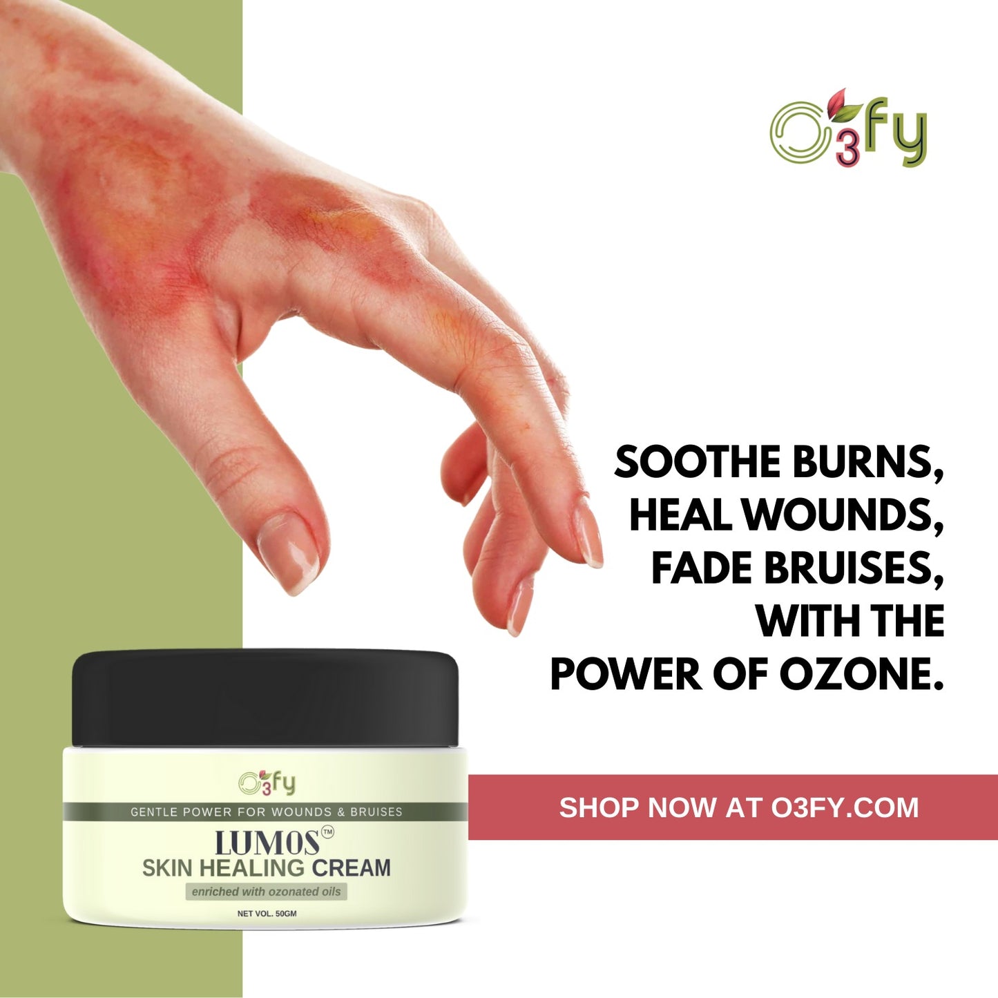 Lumos_Skin Healing Cream_burns and bruises and wounds