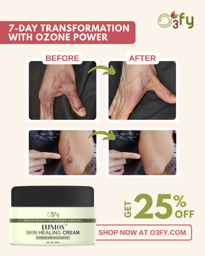 Lumos_Skin Healing Cream_burns and bruises and wounds