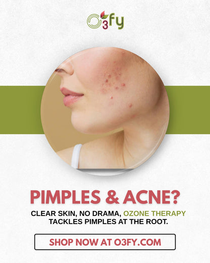 LUMOS Acne & Pimple Cream